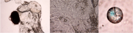 Fish hatchling otoliths in the larval head (left and centre close up) and extracted (right). The diameter of the otolith is ~ 25 microns.